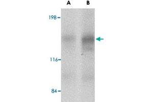 Western blot analysis of CADPS2 in human brain tissue lysate with CADPS2 polyclonal antibody  at (A) 0. (CADPS2 抗体  (Internal Region))