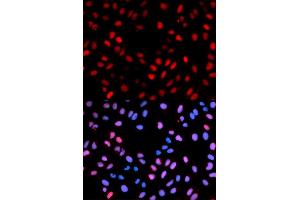 Immunofluorescence analysis of U2OS cells using Phospho-RAF1-S621 antibody. (RAF1 抗体  (pSer621))