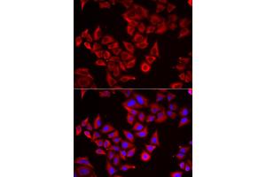 Immunofluorescence analysis of HeLa cells using SRGN antibody (ABIN5974179). (SRGN 抗体)