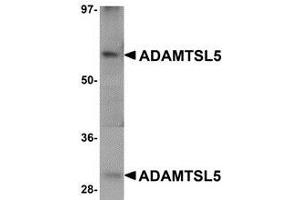 Western blot analysis of ADAMTSL5 in human skeletal muscle tissue lysate with AP30018PU-N ADAMTSL5 antibody at 1 μg/ml. (ADAMTS-Like 5 抗体  (C-Term))