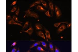 Immunofluorescence analysis of U-2 OS cells using MLPH Polyclonal Antibody at dilution of 1:100. (Melanophilin 抗体)