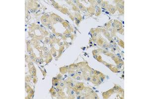 Immunohistochemistry of paraffin-embedded human stomach using ABCF2 antibody at dilution of 1:100 (x40 lens).