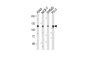 Western blot analysis of lysates from A549, MCF-7, SW620, PC-3 cell line (from left to right), using GAA Antibody at 1:1000 at each lane. (GAA 抗体  (N-Term))