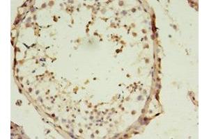 Immunohistochemistry of paraffin-embedded human testis tissue using ABIN7170098 at dilution of 1:100 (SLC13A4 抗体  (AA 134-273))