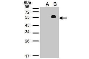 WB Image Western Blot analysis of TAB1 expression in transfected 293T cell line by MAP3K7IP1 polyclonal antibody. (TAB1 抗体)