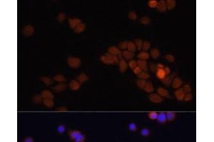 Immunofluorescence analysis of HT-29 cells using APC Polyclonal Antibody at dilution of 1:100. (APC 抗体)
