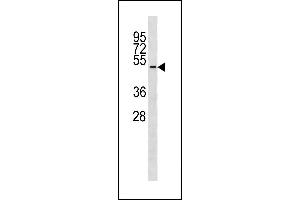 TUBD1 Antibody (C-term) (ABIN1881958 and ABIN2843289) western blot analysis in ZR-75-1 cell line lysates (35 μg/lane). (TUBD1 抗体  (C-Term))