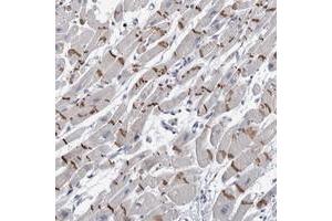 Immunohistochemical staining of human heart muscle with TMEM102 polyclonal antibody  shows distinct positivity of intercalated discs in myocytes. (TMEM102 抗体)