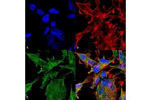 Immunocytochemistry (ICC) image for anti-Solute Carrier Family 18 (Vesicular Acetylcholine), Member 3 (SLC18A3) (AA 521-532) antibody (ABIN1027709)