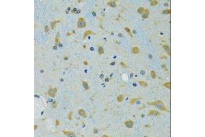 Immunohistochemistry of paraffin-embedded mouse brain using RPS7 antibody. (RPS7 抗体  (AA 1-194))