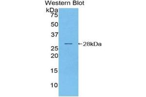 Western blot analysis of the recombinant protein. (NOD1 抗体  (AA 612-826))