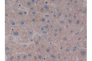 DAB staining on IHC-P; Samples: Human Liver Tissue (NPS 抗体  (AA 29-88))