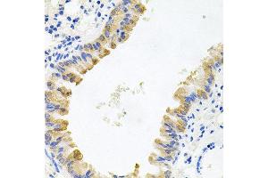 Immunohistochemistry of paraffin-embedded mouse lung using ALKBH8 antibody at dilution of 1:100 (x40 lens). (ALKBH8 抗体)