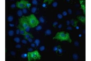 Anti-TBC1D4 mouse monoclonal antibody (ABIN2454437) immunofluorescent staining of COS7 cells transiently transfected by pCMV6-ENTRY TBC1D4 (RC212105). (TBC1D4 抗体)