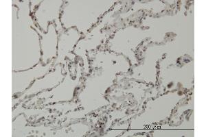 Immunoperoxidase of monoclonal antibody to PIM1 on formalin-fixed paraffin-embedded human lung. (PIM1 抗体  (AA 1-313))