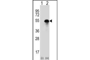 Western blot analysis of CA14 (arrow) using rabbit polyclonal CA14 Antibody (N-term) (ABIN391473 and ABIN2841441). (CA14 抗体  (N-Term))