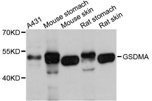 Western blot analysis of extracts of various cell lines, using Gsdma antibody (ABIN5997852) at 1/1000 dilution. (Gasdermin A 抗体)