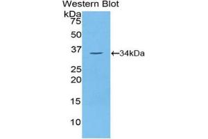 Western blot analysis of the recombinant protein. (NEK2 抗体  (AA 137-400))