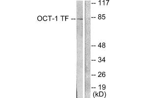 Western Blotting (WB) image for anti-POU Domain, Class 2, Transcription Factor 1 (POU2F1) (N-Term) antibody (ABIN1848704) (POU2F1 抗体  (N-Term))