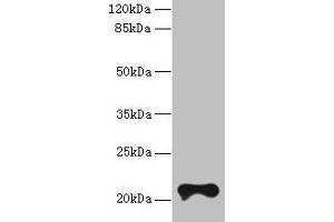 Western blot All lanes: TMEM154 antibody at 6 μg/mL + MCF-7 whole cell lysate Secondary Goat polyclonal to rabbit IgG at 1/10000 dilution Predicted band size: 21 kDa Observed band size: 21 kDa (TMEM154 抗体  (AA 97-183))