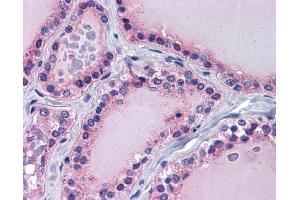 Immunohistochemistry (IHC) image for anti-Paired Box 8 (PAX8) (Middle Region) antibody (ABIN501324) (PAX8 抗体  (Middle Region))