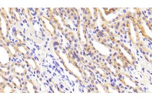 Detection of MMP1 in Rat Kidney Tissue using Polyclonal Antibody to Matrix Metalloproteinase 1 (MMP1) (MMP1 抗体  (AA 169-464))