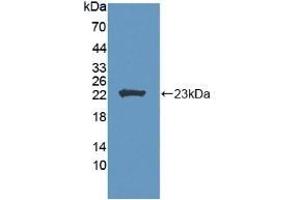 Detection of Recombinant LCAT, Human using Polyclonal Antibody to Lecithin Cholesterol Acyltransferase (LCAT) (LCAT 抗体  (AA 41-210))