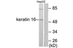 Western blot analysis of extracts from HepG2 cells, using Keratin 16 Antibody. (KRT16 抗体  (AA 421-470))