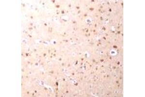 Immunohistochemical staining of human brain tissue with 2. (NANOS3 抗体  (C-Term))