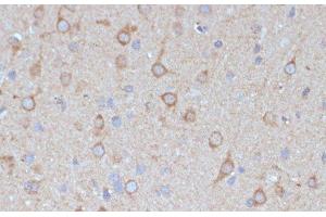 Immunohistochemistry of paraffin-embedded Rat brain using COPG2 Polyclonal Antibody at dilution of 1:100 (40x lens). (COPG2 抗体)