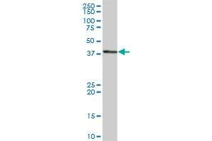 Western Blotting (WB) image for anti-General Transcription Factor IIH, Polypeptide 2, 44kDa (GTF2H2) (AA 1-395) antibody (ABIN516267)