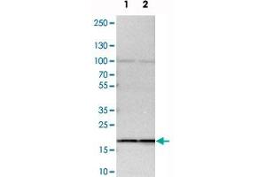 Western blot analysis of cell lysates with SSR3 polyclonal antibody . (SSR3 抗体)