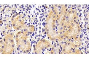 Detection of ALPL in Mouse Kidney Tissue using Polyclonal Antibody to Alkaline Phosphatase, Tissue-nonspecific (ALPL) (ALPL 抗体  (AA 18-335))