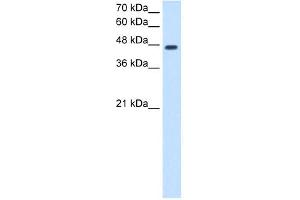 NDRG1 antibody used at 2. (NDRG1 抗体  (N-Term))