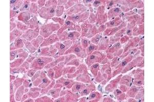 Immunohistochemistry of ARC in human heart tissue (A) and skeletal muscle (B) with ARC antibody at 5 μg/ml. (NOL3 抗体  (C-Term))