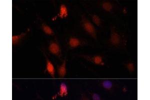 Immunofluorescence analysis of C6 cells using GBX2 Polyclonal Antibody at dilution of 1:100. (GBX2 抗体)
