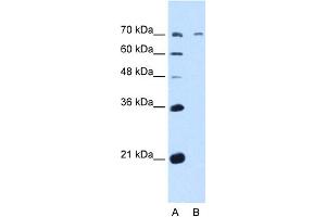 WB Suggested Anti-GALNT6 Antibody Titration:  5. (GALNT6 抗体  (N-Term))