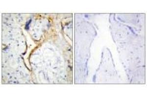 Immunohistochemistry analysis of paraffin-embedded human placenta tissue using CKI-ε antibody. (CK1 epsilon 抗体)