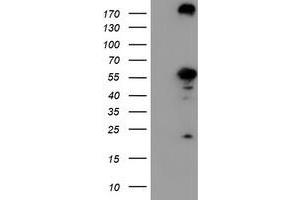 Western Blotting (WB) image for anti-CNDP Dipeptidase 2 (Metallopeptidase M20 Family) (CNDP2) antibody (ABIN1497548) (CNDP2 抗体)