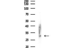 anti-Phosphoglycerate Mutase Family Member 5 (PGAM5) (Internal Region) antibody