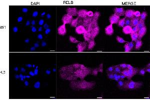 Immunocytochemical staining of HT- cells using RELB antibody (ABIN7800804), 1:1,000), Top panel: wild-type (WT), Bottom panal: RELB shRNA knockdown (KD). (Recombinant RELB 抗体)