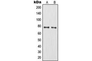 Western blot analysis of MMP9 expression in HT1080 (A), HuvEc (B) whole cell lysates. (MMP 9 抗体  (C-Term))