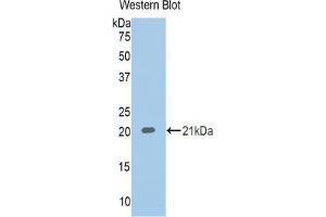 Western blot analysis of recombinant Human CBG. (SERPINA6 抗体  (AA 218-378))
