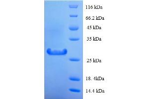 SDS-PAGE (SDS) image for Lysozyme (LYZ) (AA 19-148) protein (His-SUMO Tag) (ABIN5709889)