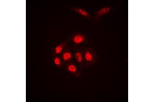 Immunofluorescent analysis of Histone H4 (AcK16) staining in HEK293T cells. (Histone H4 抗体  (acLys16, N-Term))