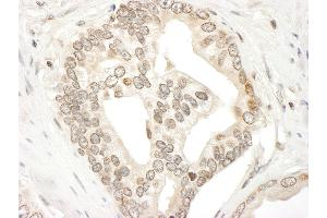 Immunohistochemistry (IHC) image for anti-Janus Kinase 2 (JAK2) (AA 1082-1132) antibody (ABIN7454809) (JAK2 抗体  (AA 1082-1132))