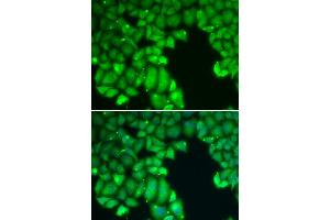 Immunofluorescence analysis of U2OS cells using CASP10 antibody (ABIN5970048). (Caspase 10 抗体)