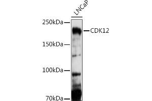 Western blot analysis of extracts of LNCaP cells, using CDK12 antibody (ABIN7266230) at 1:1000 dilution. (CDK12 抗体  (AA 80-290))