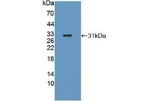 Detection of Recombinant b4GALNT2, Human using Polyclonal Antibody to Beta-1,4-N-Acetyl Galactosaminyl Transferase 2 (b4GALNT2) (B4GALNT2 抗体  (AA 324-566))