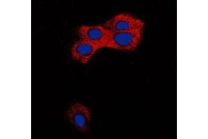 Immunofluorescent analysis of TGF beta 1 staining in MCF7 cells. (TGFB1 抗体  (C-Term))